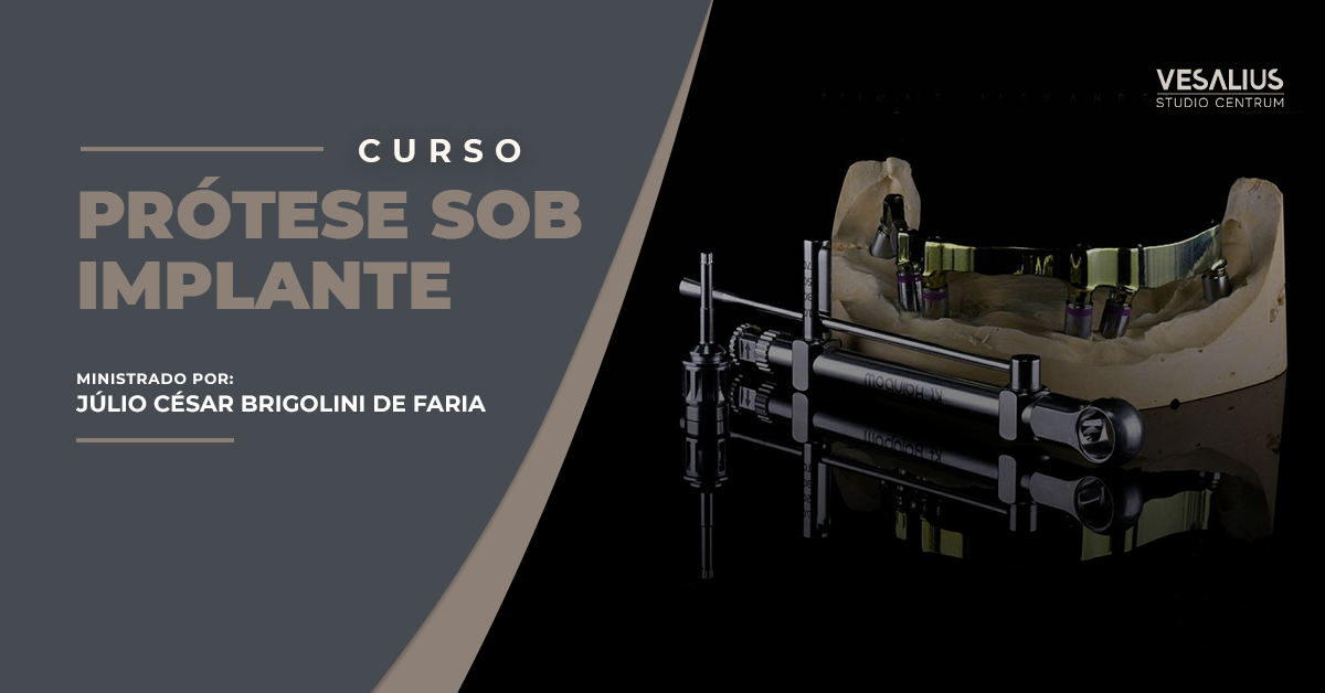 Curso de Prótese Sob Implante